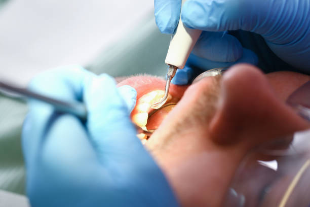 Best Emergency Dental Care for Broken or Chipped Teeth in Pleasant Prairie, WI