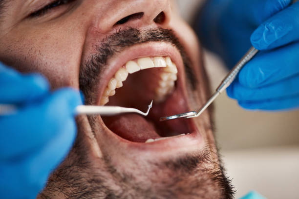 Best Emergency Treatment for Dental Infections or Abscesses in Pleasant Prairie, WI